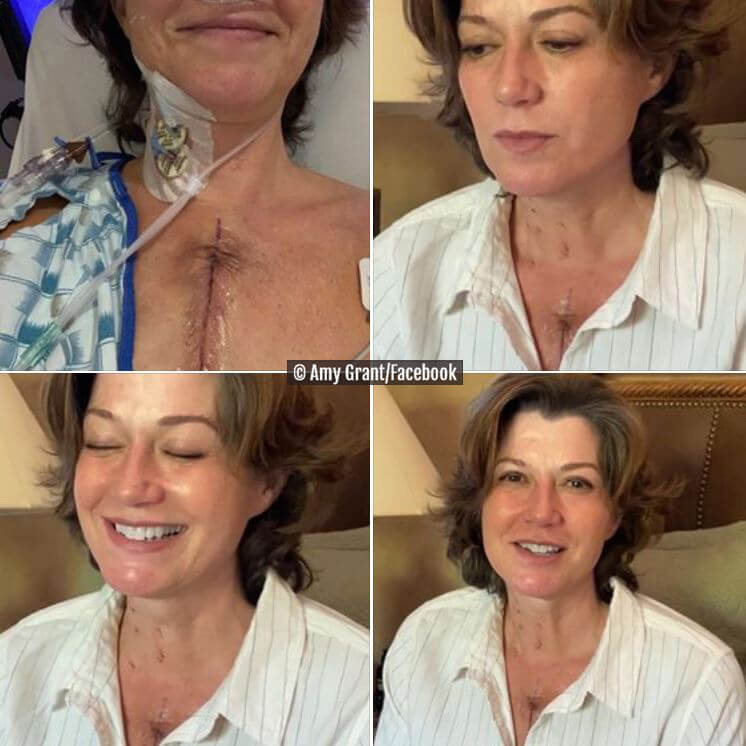 Amy Grant_Open Heart Surgery_Scar
